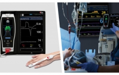 New Study Finds Significant Correlation Between Masimo ORi and Arterial Partial Pressure of Oxygen During One-Lung Ventilation